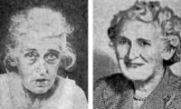 Některým pacientům lobotomie údajně pomohla. Vlevo je snímek ženy před zákrokem, vpravo stejná žena o nějaký čas později.